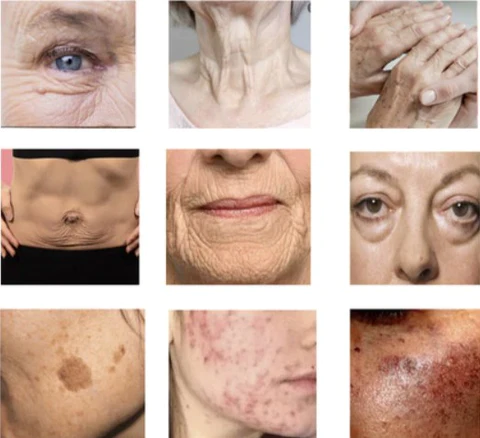 Biancat ™ SwanPro Hydrolyzed Collagen Neck Cream