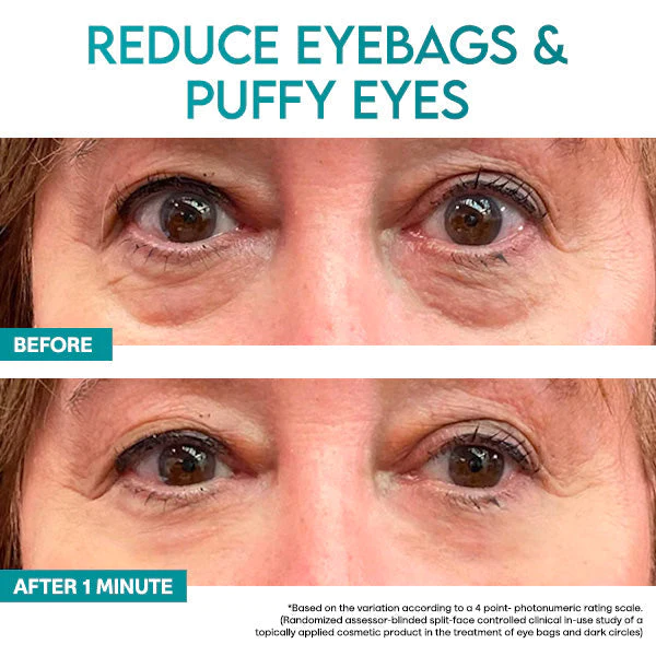 BlinkMagic Instant HyperLift Eye Krema