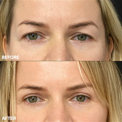 BlinkMagic Instant HyperLift Eye Krema