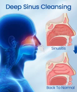 جهاز العلاج Ceoerty™ BreatheBright Nasal LED