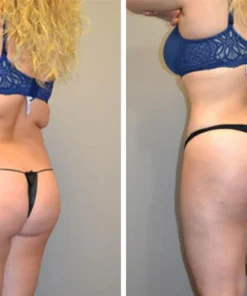 شورت Ceoerty™ SculptFast Ion Shaping