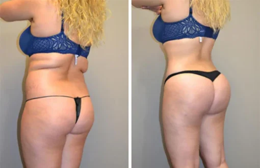 شورت Ceoerty™ SculptFast Ion Shaping