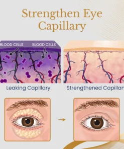 Ceoerty™ AgeErase Collagen Eye Cream