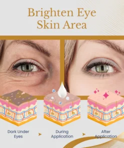 Ceoerty™ AgeErase Collagen Eye Cream