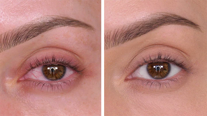 Ceoerty™ EyeRelax Patches