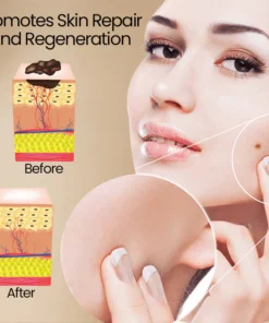 Ceoerty™ Bee Venom ClearSkin Wart and Tags Removal Treatment Spray