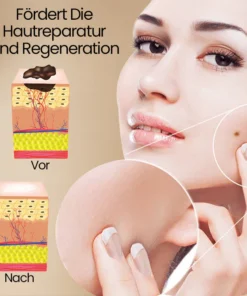 Ceoerty™ Bee Venom ClearSkin Warzen- und Tags-Entfernungs-Spray