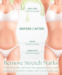 Ceoerty™ ElastiSkin Collagen Firming Skin Oil