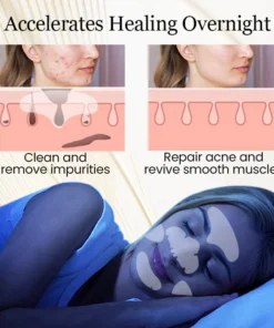 Ceoerty™ Hydrogel Acne Patch