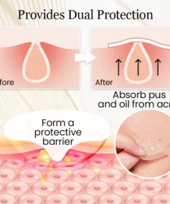 Ceoerty™ Hydrogel Acne Patch