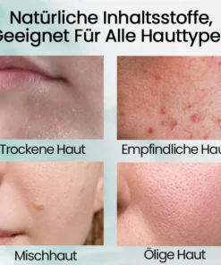 Ceoerty™ LuminaSkin Multi-Effekt Aufhellungscreme