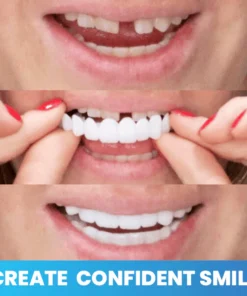 Ceoerty™ PRODent Adjustable Snap Prosthesis