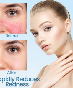 Ceoerty™ Skin Soothing Redness Relief Cream