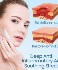 Ceoerty™ Skin Soothing Redness Relief Cream