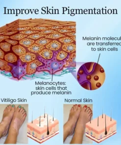 Ceoerty™ Vitiligo Vanish Cream