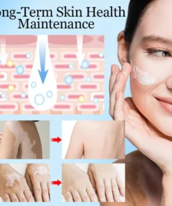 Ceoerty™ Vitiligo Vanish Cream