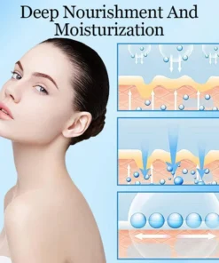 Ceoerty™ Vitiligo Vanish Cream