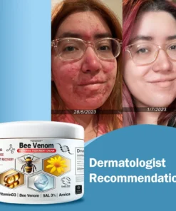 Cvreoz™ Krem leczący wieloobjawową łuszczycę z jadem pszczelim