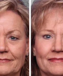 DewyEye™ Caffeine Depuffing Eye Gel