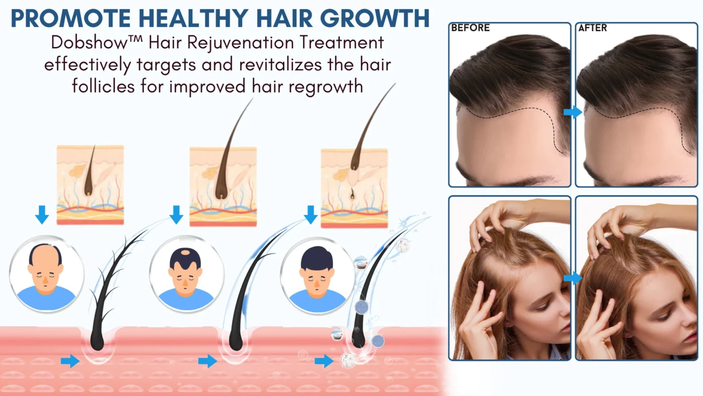 Dobshow™ Hair Rejuvenation Treatment & Stimulating Scalp Massager