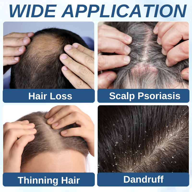 Dobshow™ Hair Rejuvenation Treatment & Stimulating Scalp Massager