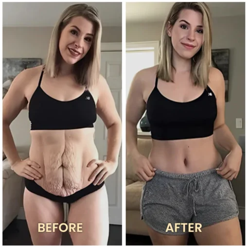 Dobshow™ IonFiberFar Infrared Recovery Shaper Bodysuit بدون ظهر