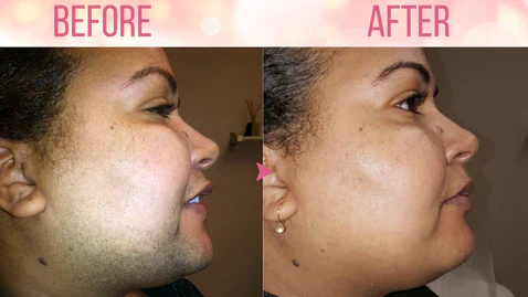 Dobshow™ Beeswax Hair Removal Mousse