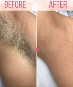 Dobshow™ Beeswax Hair Removal Mousse