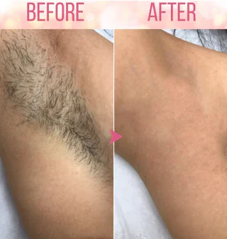 Dobshow™ Beeswax Hair Removal Mousse