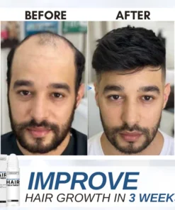 Dobshow™ Hair Rejuvenation Treatment & Stimulating Scalp Massager