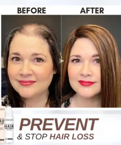 Dobshow™ Hair Rejuvenation Treatment & Stimulating Scalp Massager