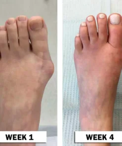 Dobshow™ New Zealand Bee-Infused Joint and Bone Therapy Advanced Cream