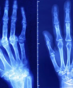 Dobshow™ New Zealand Bee-Infused Joint and Bone Therapy Advanced Cream