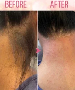 EELHOE Beeswax Hair Removal Mousse