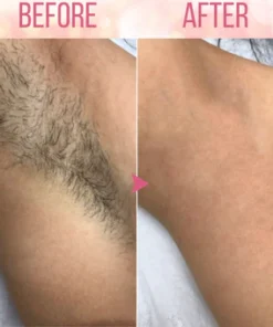 EELHOE Beeswax Hair Removal Mousse