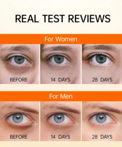 EYEPLUS™ Vitamin C Depuffing Eye Serum