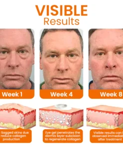 EYEPLUS™ Vitamin C Depuffing Eye Serum