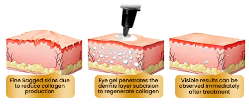 EyeRevive™ Firming Eye Cream - Solve Eye Skin Problems