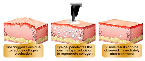 EyeRevive™ Firming Eye Cream - Ebatzi begien larruazaleko arazoak
