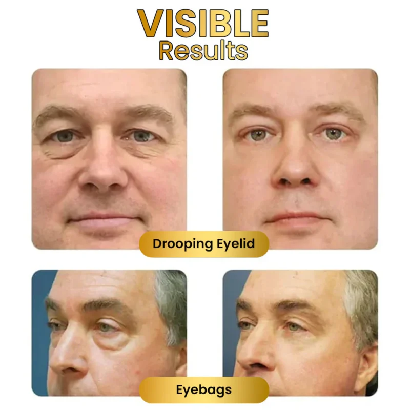 EyeRevive™ Firming Eye Cream - Ebatzi begien larruazaleko arazoak