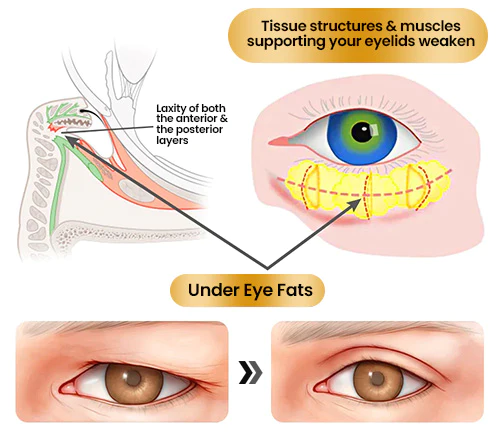 EyeRevive™ Begietako krema sendotzea