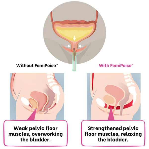 FemiPoise™ Maskurraren Kontrol Gela