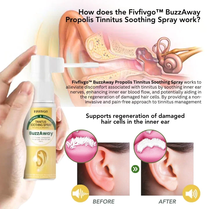 Fivfivgo™ BuzzAway Propolis Tinnitus Beruhigungsspray