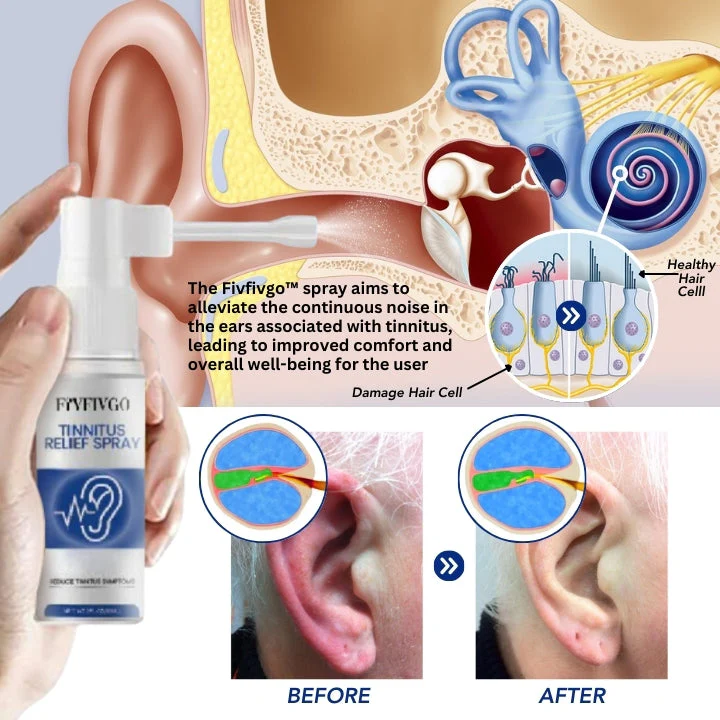 Fivfivgo™ Tinnitus-Linderungsspray