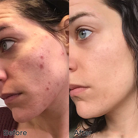 Fivfivgo™ Anti-Oxidationsmittel-Verjüngungs-Phagozyten-Pflaster