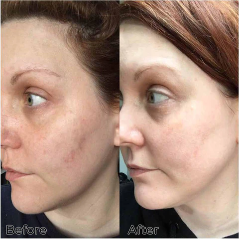 Fivfivgo™ Anti-Oxidationsmittel-Verjüngungs-Phagozyten-Pflaster