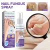 Fivfivgo™ Anti-Pilz-Nagelspray