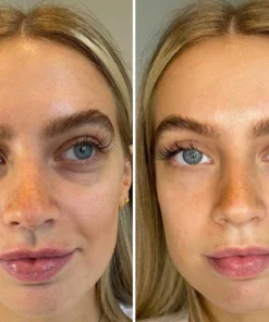 Fivfivgo™ Ausstrahlung Unteraugen-Konturcreme