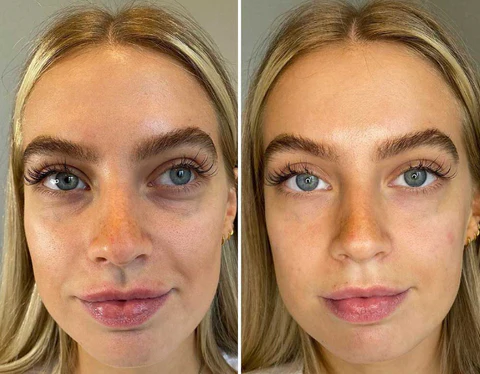 Fivfivgo™ Ausstrahlung Unteraugen-Konturcreme