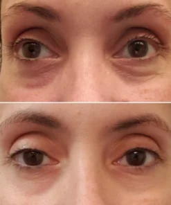 Fivfivgo™ Ausstrahlung Unteraugen-Konturcreme